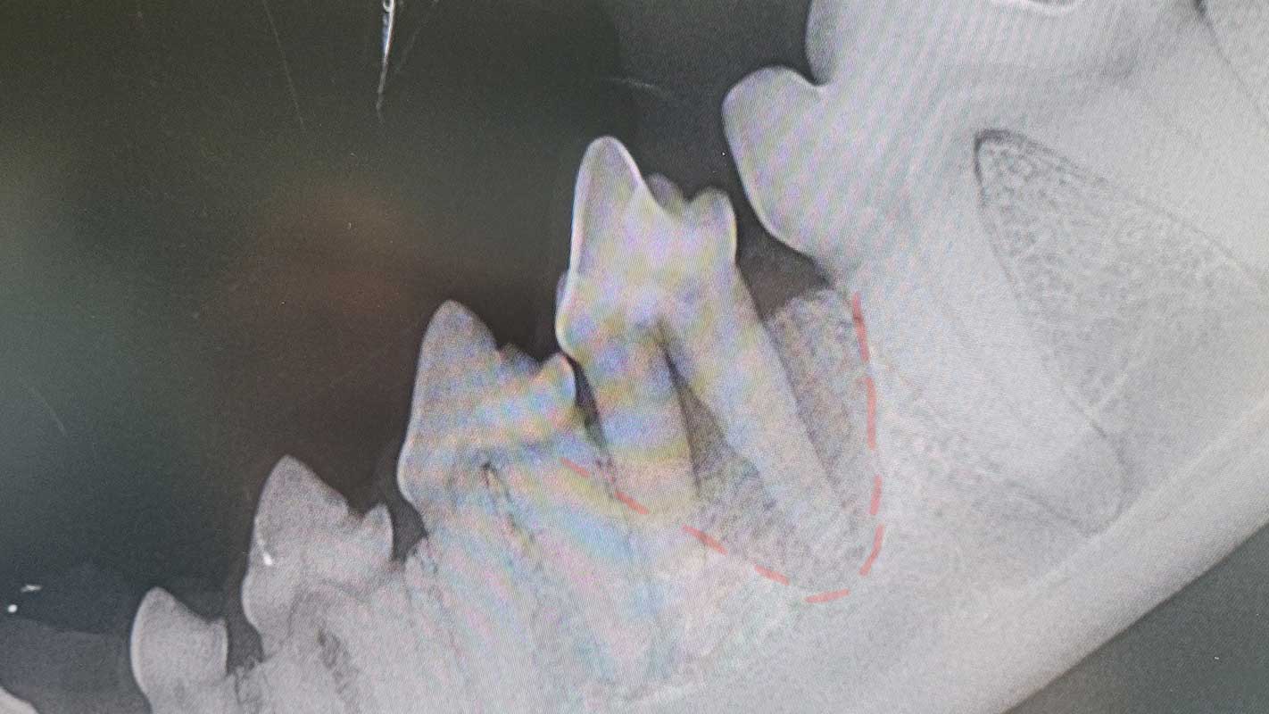 tierarztpraxis-poll-parodontitis-roentgenbild Röntgenbild bei fortgeschrittener Parodontitis