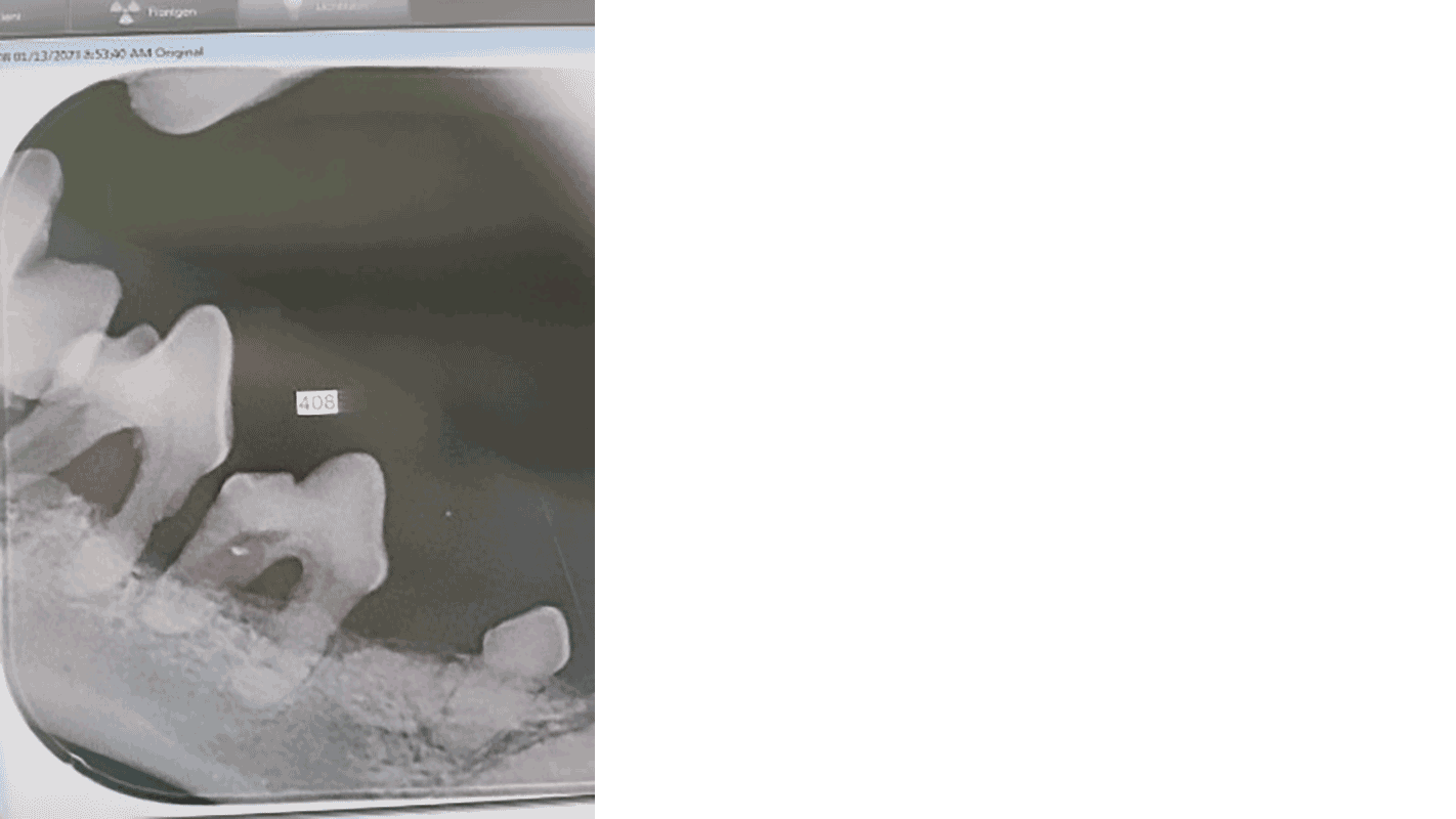 tierarztpraxis-poll-zahnstein-roentgenbild Röntgenbild bei Zahnstein und geschwollenem Zahnfleisch